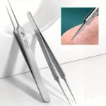 Stainless Steel Blackhead Removal Kit (3 Tweezers) - Image 2