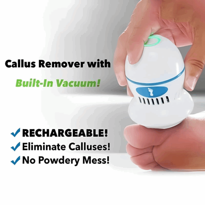 New Electric Foot Grinder Skin Hard Rupture Skin Trimmer Dead Skin - Image 7